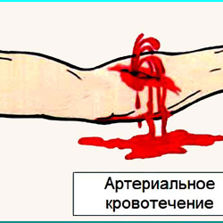 Arteriální krvácení první pomoci
