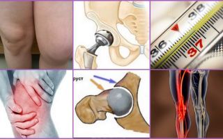 Orsaker och behandling av smärta efter total knä- och höftleder