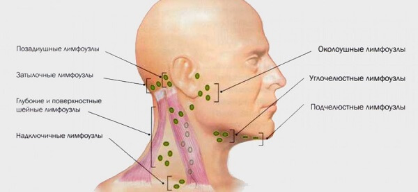 What to do if the neck has blown: how to treat at home
