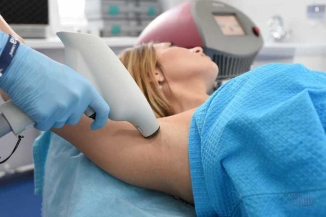 The use of laser therapy for excessive sweating: the benefits of treatment