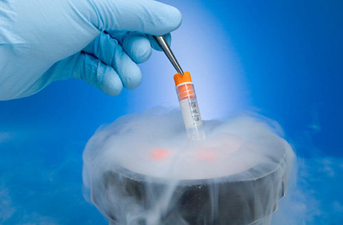 Cryopreservation of sperm