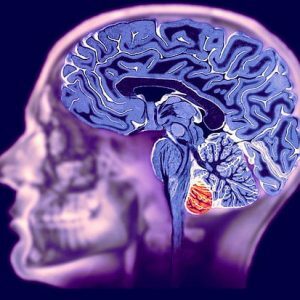 reading-a-cérebro MRI do cérebro