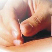 Schlaganfall: Behandlung mit Akupunktur