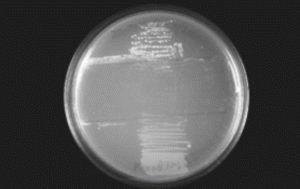 Análise de microflora