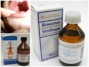 Vinylinum pozitív hatást a kezelés stomatitis