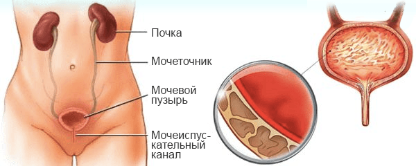 Outra causa de dor no abdome inferior são as doenças do sistema urinário.
