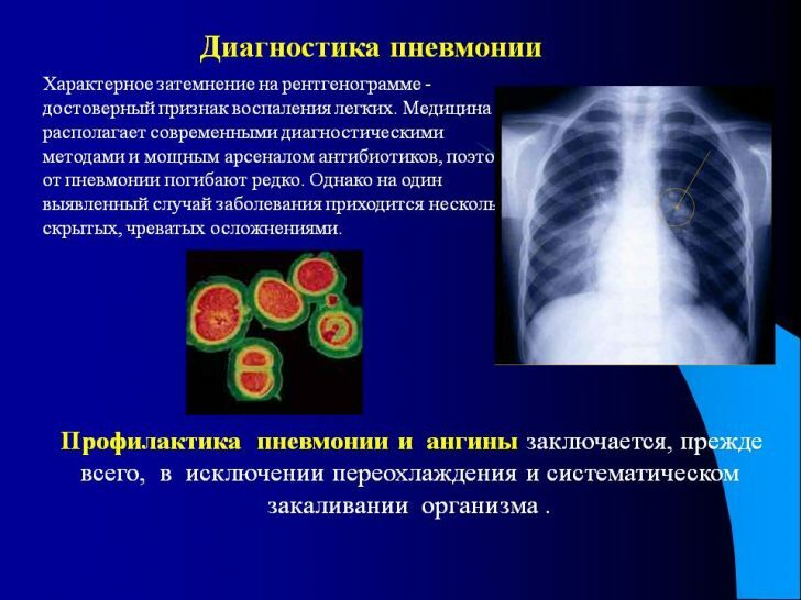 0008-008-Diagnostics-pneumonie
