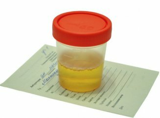 testovi urina