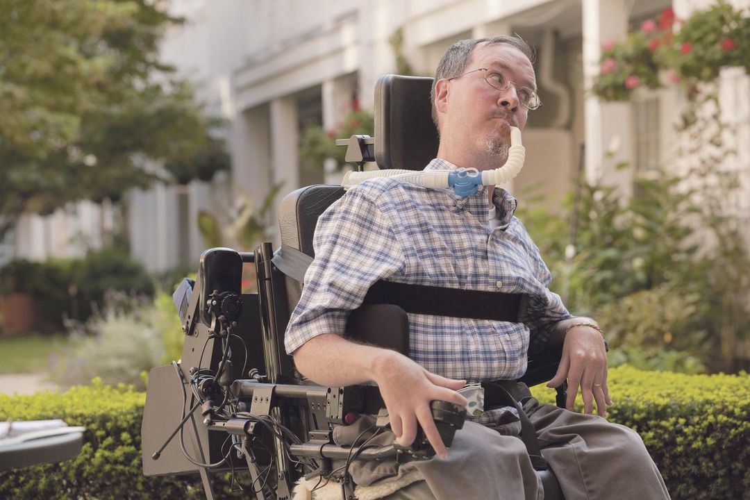 Amyotrophic lateral sclerosis (ALS): causes, symptoms, treatment