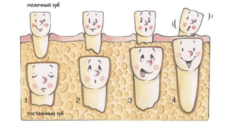 Čas izraščanja stalnih zob otrok simptomov