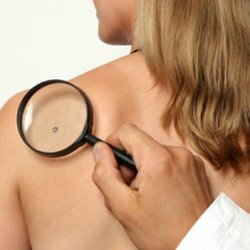Measures to prevent skin cancer