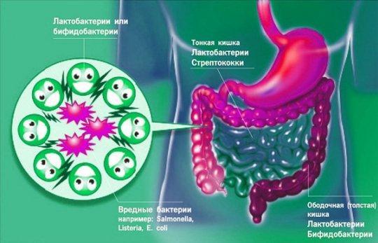 Disbacteriose do intestino humano