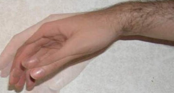 Tremor of Fingers: Wie loswerden ein unangenehmes Symptom?