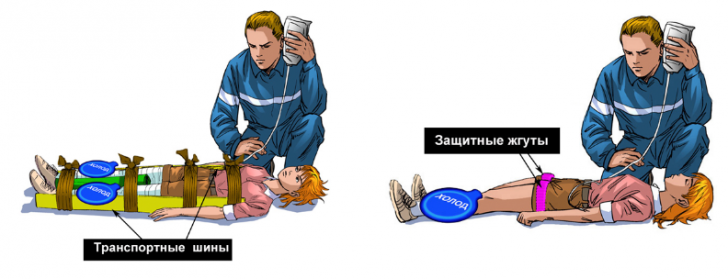 First aid in the syndrome of prolonged compression and its treatment
