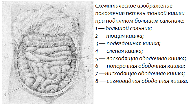 Representación esquemática de la posición de las asas del intestino delgado con epiplón elevado