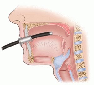 Menselijke esophagogastroduodenoscopie