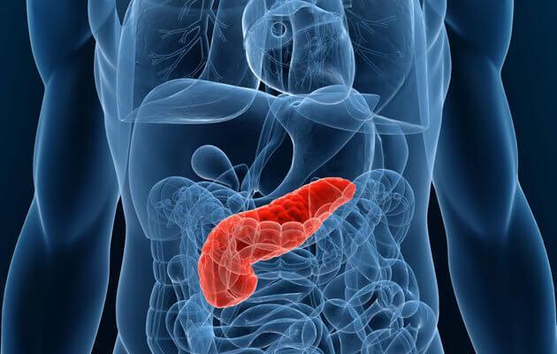Por que o câncer de pâncreas se desenvolve?