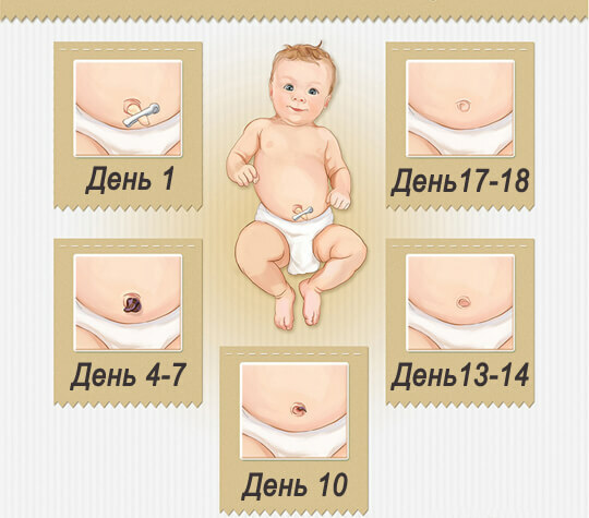 Krovit_popok_u_ newborn