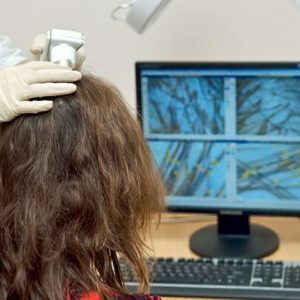 Diagnosis of hair loss