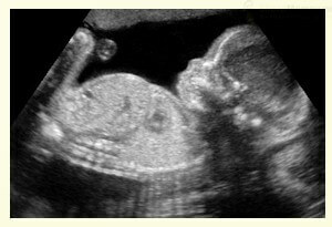 23-Week-Pregnancy