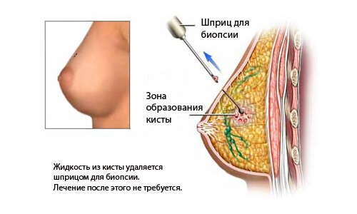 Diagnosis of the gland