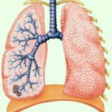 Chronische uitwissing bronchiolitis