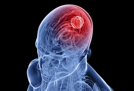 Konsekvenserna av nederlag och sjukdomar i cerebellum