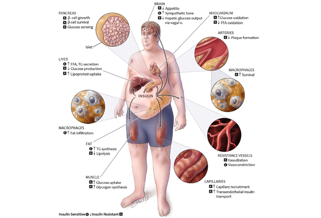 Klasifikácia chronickej gastritídy