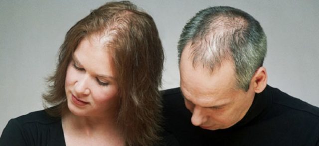 Causes of hair loss: hair loss in men and women
