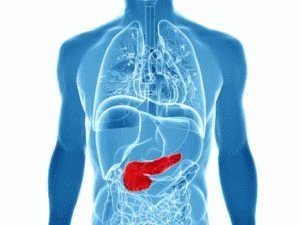 Pancreatitis ziekte