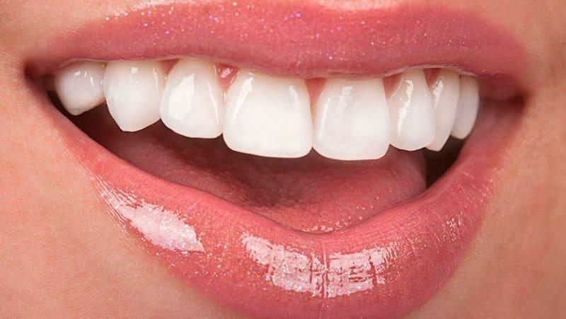 Blødende tandkød: hvad man skal gøre