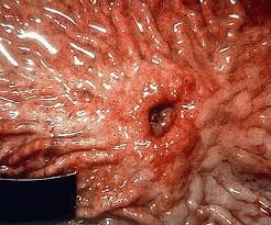 Chronische pathologie