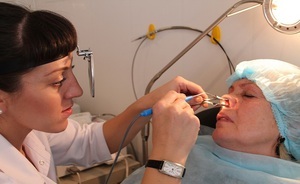 Okai arcüreggyulladás után sinus lifting fogászati ​​implantátumok
