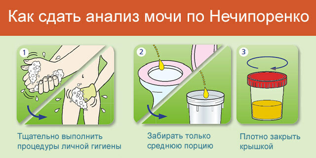 regels-delivery analyse-urine-on-Nechiporenko
