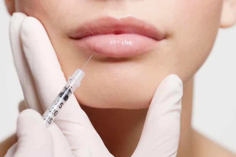 Zubereitungen für Lippenvergrößerung Hyaluronsäure