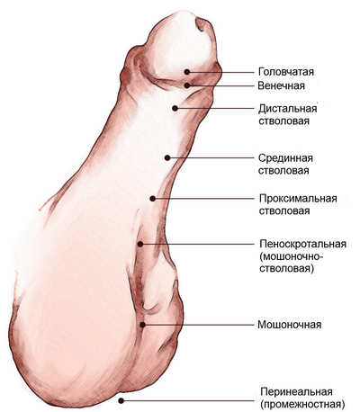 Types of hypospadias