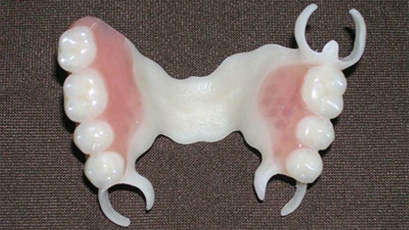 Polyuretan zubní protézy: zubní technici recenze a ceny