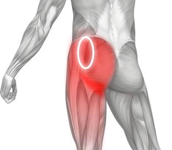 Inflammation of the sciatic nerve: symptoms and treatment