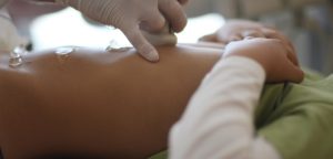 Ultrazvuk gastrointestinálneho traktu dieťaťa