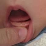 Dentition enfant à 3 mois