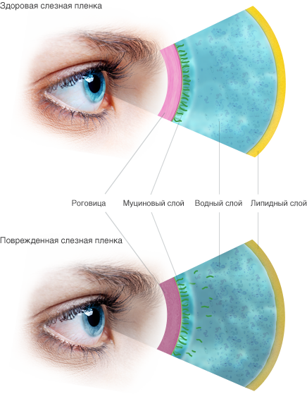 Príčiny syndrómu "suchého oka"