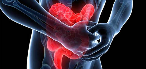 Nespecifična ulcerozni kolitis: simptomi i liječenje