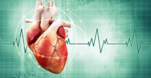Patient arrhythmia