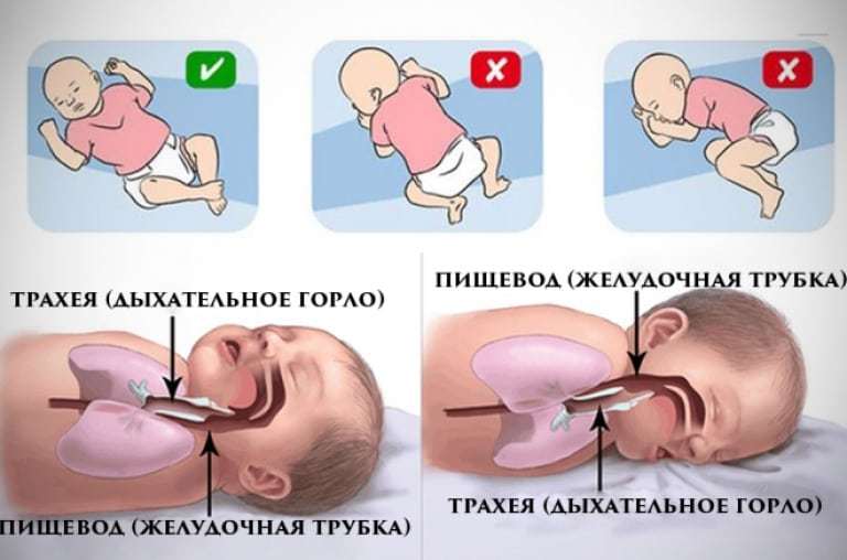 Sindrom nenadne smrti dojenčka (SIDS): vzroki, simptomi