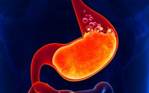 Acid in the stomach
