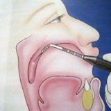 Surgical treatment of snoring