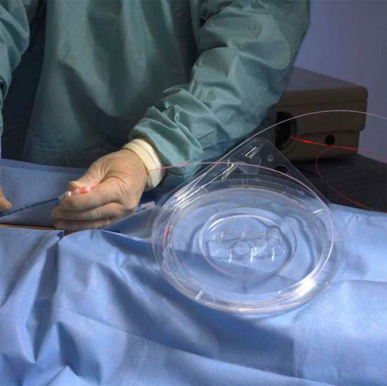 Fragmentering av gallsten - förmågan att undvika kirurgiskt ingrepp