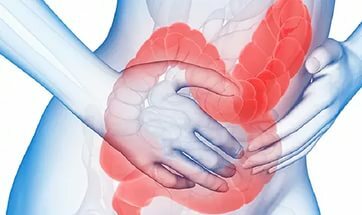 Upalna bolest crijeva: Simptomi i liječenje