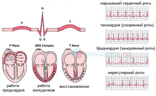 ekg