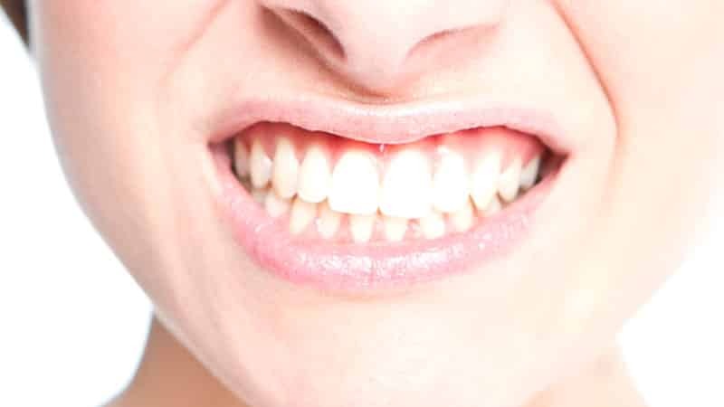 los dientes y las encías enfermedad en los seres humanos